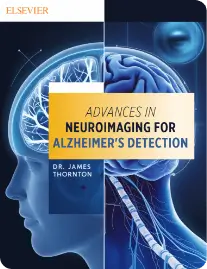 Neuroimaging For Alzheimers Detection